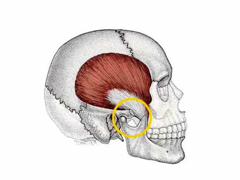 Odontocentro - A articulação temporomandibular (ATM) funciona como uma  dobradiça que liga a mandíbula ao crânio. Esta disfunção pode causar dor e  desconforto. 😰😰 Dores no maxilar, dificuldade de mastigar e estalos